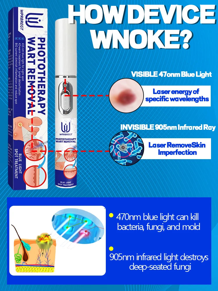 Best Wart Removal Pen Painless