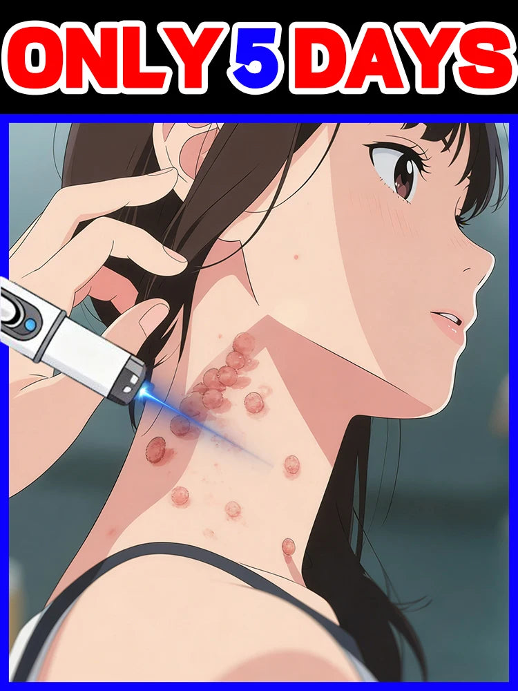 Best Wart Removal Pen Painless